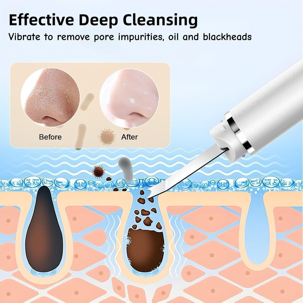Ultrasonic Blackhead Remover Exfoliating Device, Deep Pore Cleansing, Deep Cleansing Facial Cleansing, 4 Modes Blackhead Removal, Rechargeable by